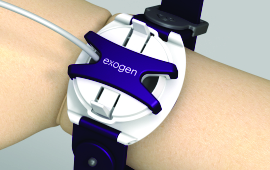 Exogen Transducer Strap Design Investigation